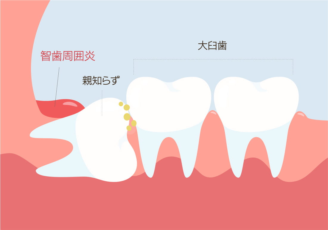 採用情報